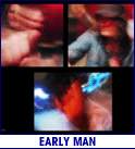 EARLY MAN (photo)